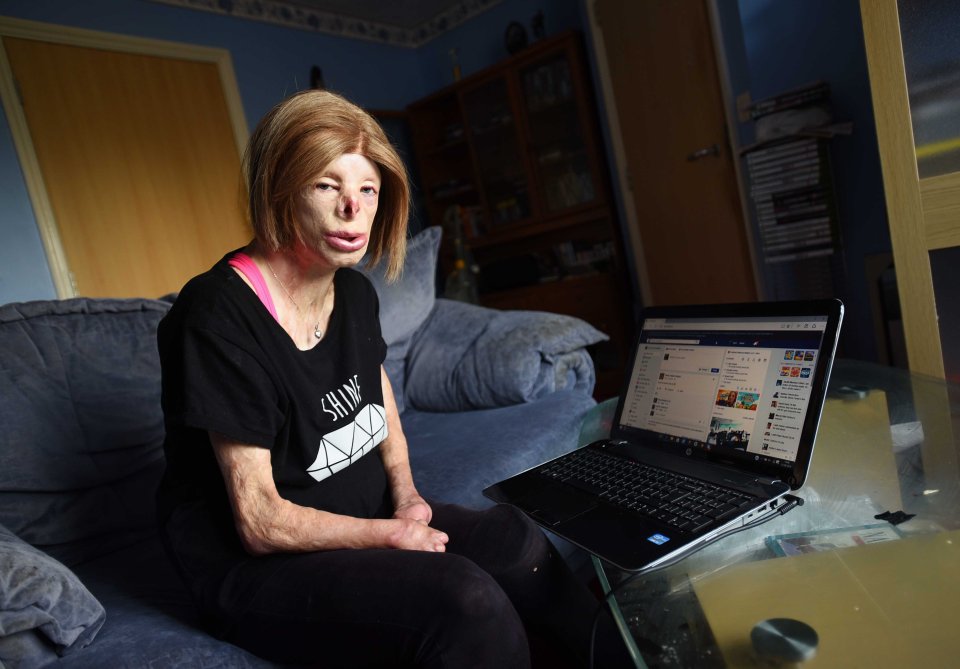  Terri Calvesbert was targeted by twisted trolls saying she was "ashamed of being deformed"