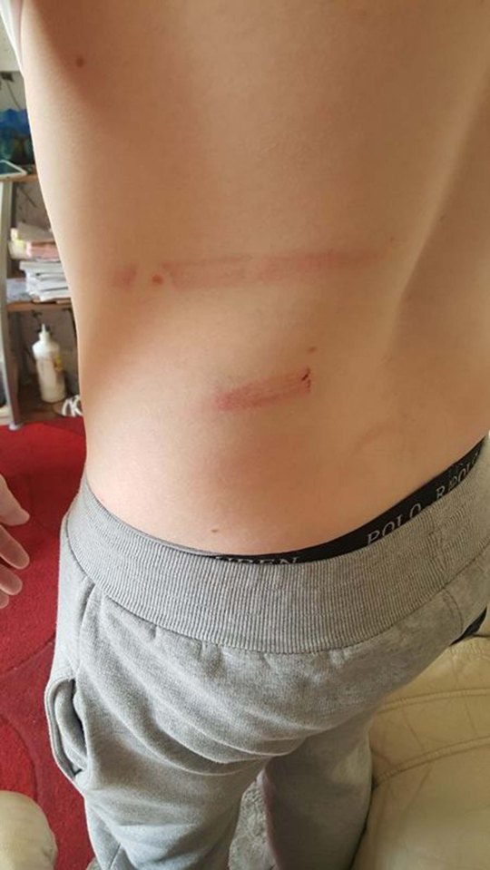  Jason said he was attacked with a metal pole that looked like it had come from a child's scooter