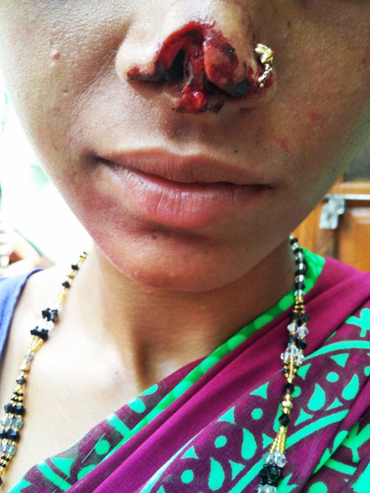  Kamlesh was pinned down as her nose was hacked off