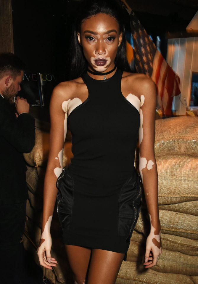  Winnie Harlow wowed in a skintight black dress