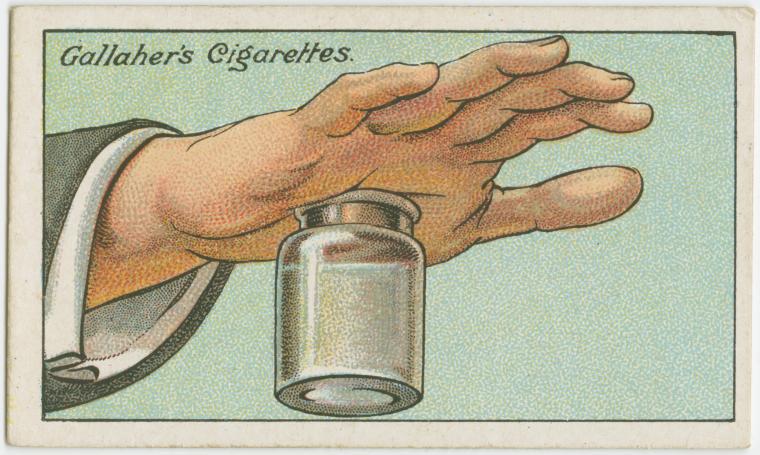  Fill a wide-mouthed bottle with hot water and press the hand against the mouth of the bottle to help get a painful splinter out