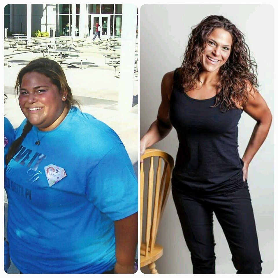 Lyss managed to lose half of her body weight through diet and exercise after bariatric surgery