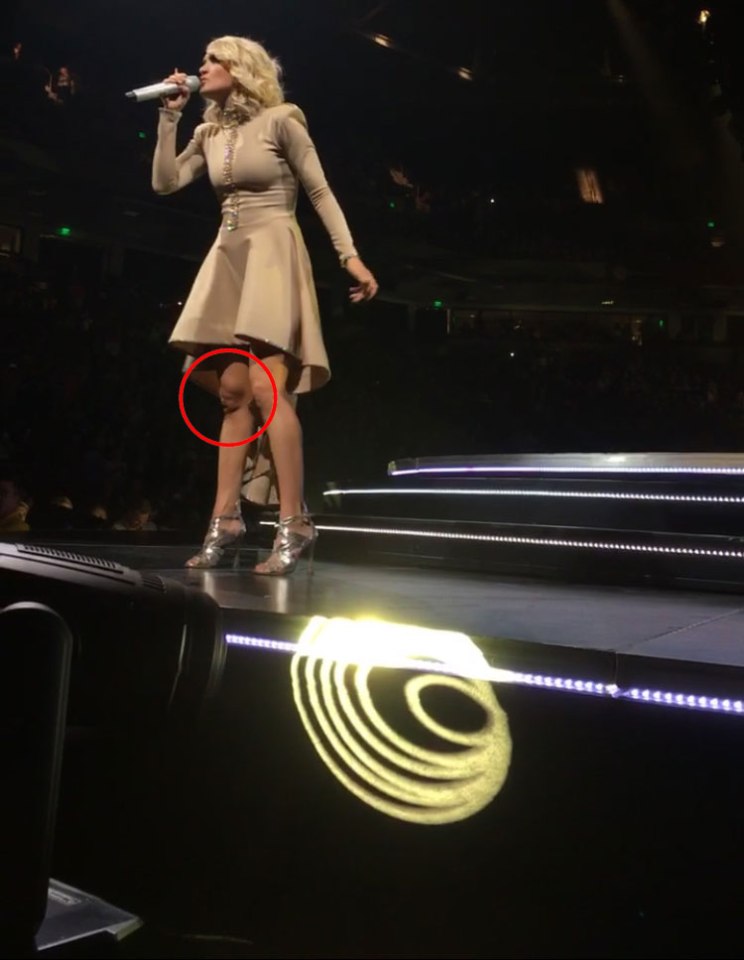  Carrie Underwood appears to have a face peering out of her knee