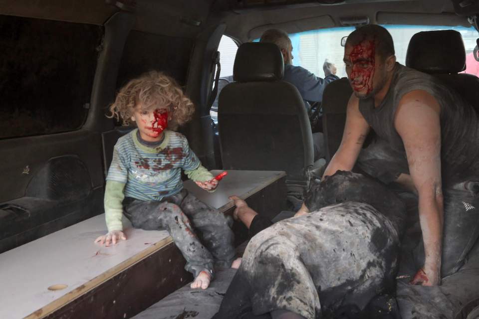  A wounded Syrian child looks on from inside a vehicle