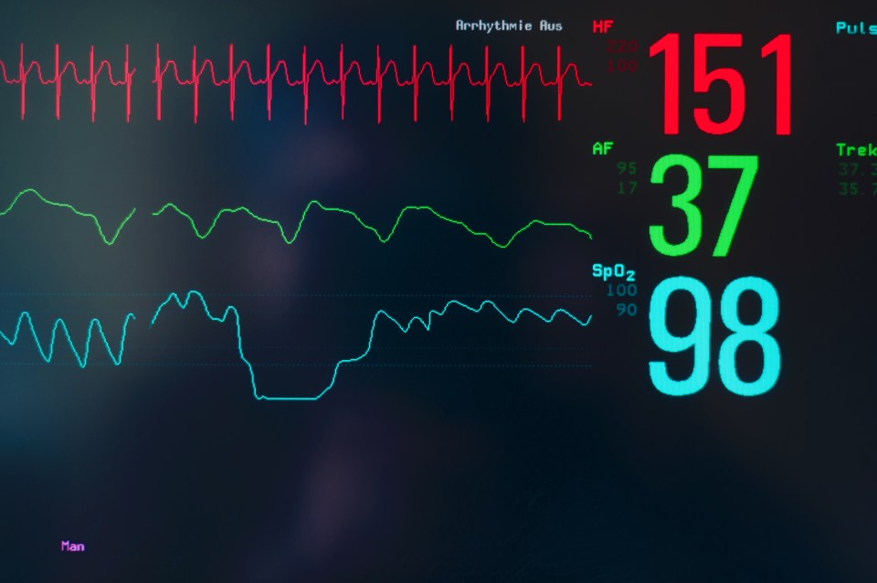 The app screens for an irregular heart rate - or atrial fibrilation - which increases the risk of stroke, heart failure and early death