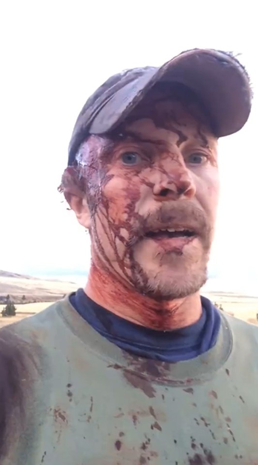  Here the amount of blood from a large gash on Todd's head is obvious after the two bear attacks