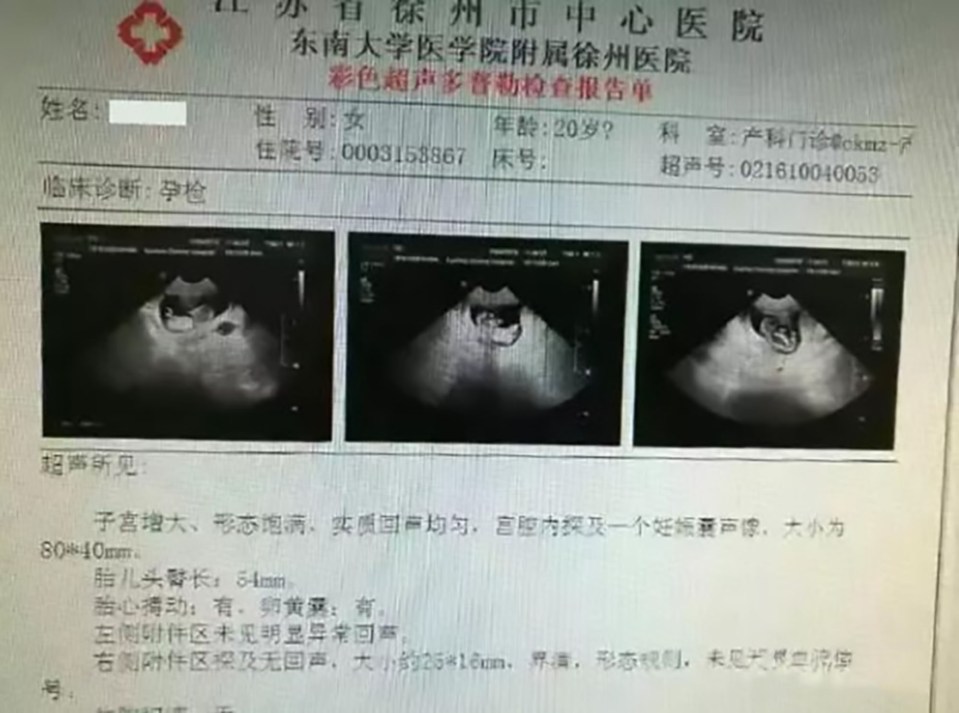  Three-months pregnant ... Girl is believed to be no older than 12 years old