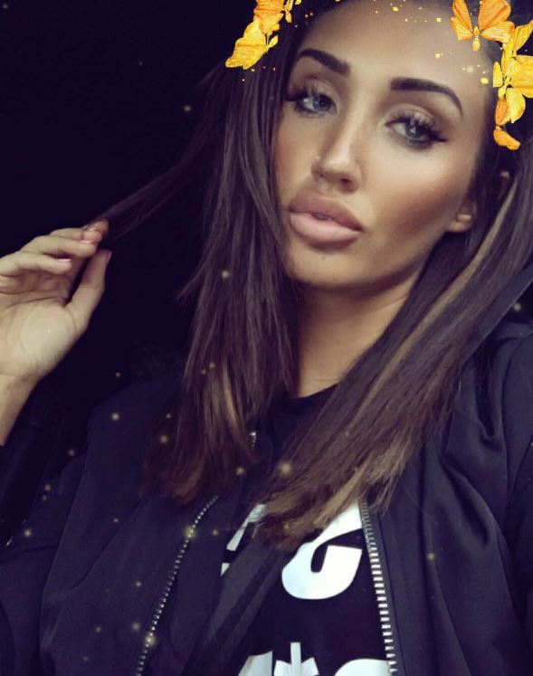  Megan McKenna revealed her newly plumped up pout on Instagram