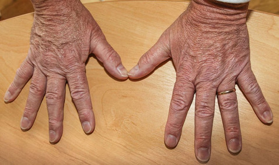  Mr Hookem had released a picture of his hands to try and prove he didn't hit his former colleague