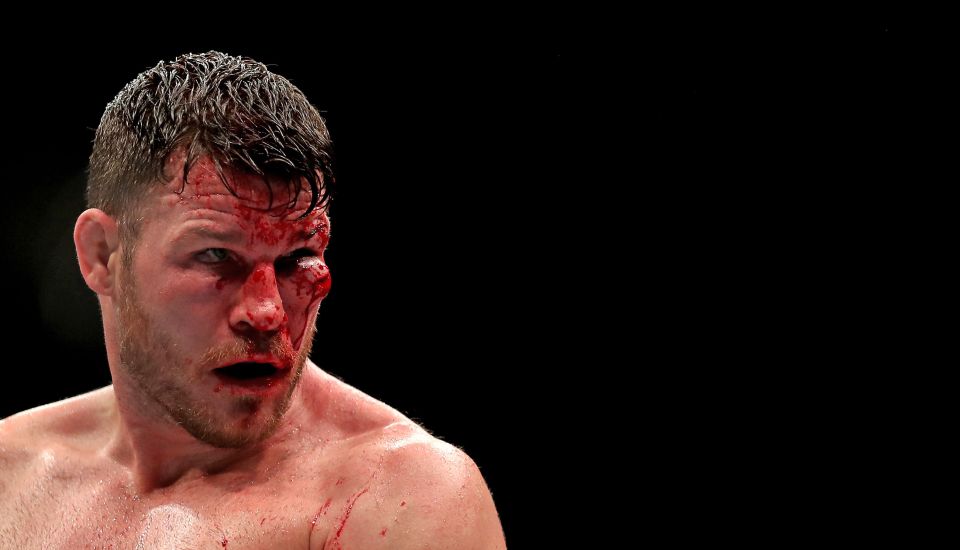  Bisping had blood gushing from beneath his left eye