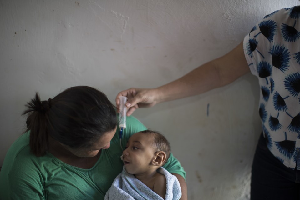 The condition caused many of the affected babied to be born with abnormally small skulls