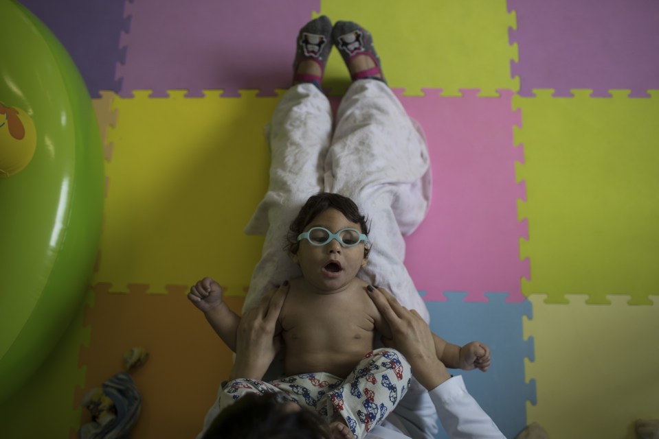 Lucas Matheus, who was born with microcephaly, during his physical therapy session at the UPAE hospital in Caruaru, Pernambuco state