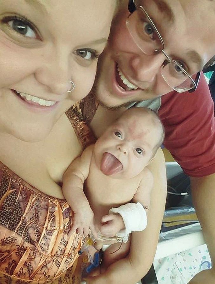  The tot's tongue shocked doctors, who said it was one of the largest they'd ever seen