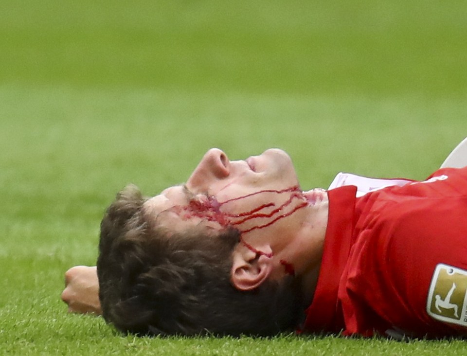 Thomas Muller was left with blood streaming down his face after clash