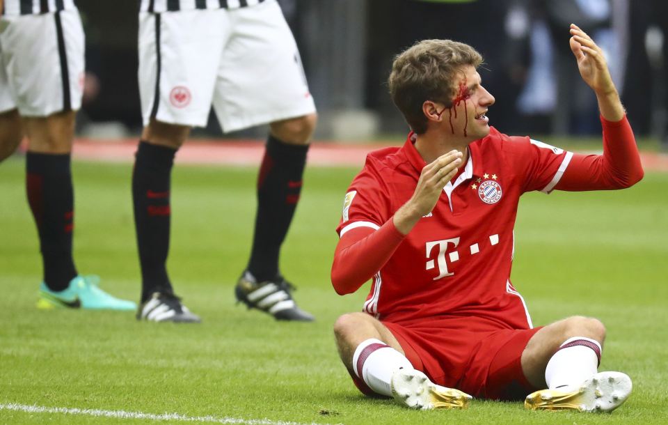 Bayern Munich ace Thomas Muller required treatment to stop the bleeding