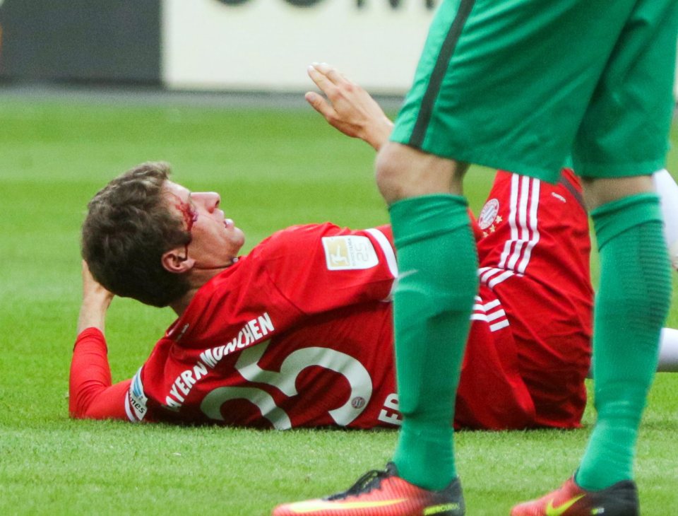 Thomas Muller crashed to the ground with blood gushing from his eye