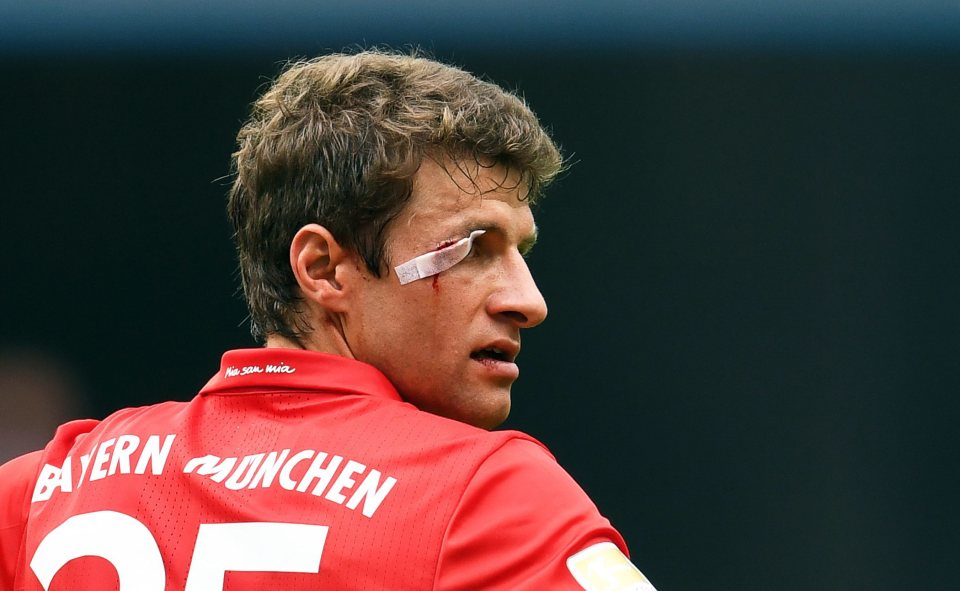 Bayern Munich's medical team used butterfly stitches to fix the gash