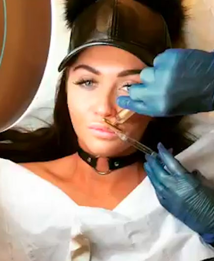 Charlotte Dawson revealed she has had lip fillers ahead of her birthday