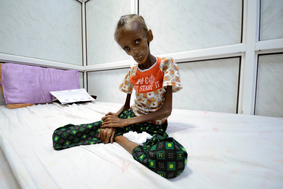  Yemen is on the brink of famine following the breakout of civil war last year