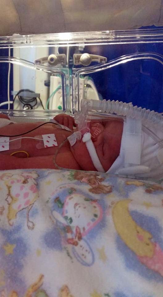  Fleur-Rose was born two and a half months early and weighed just 4lbs when she was born