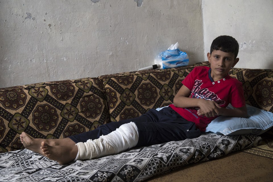  Adnan, 12, whose leg was broken when an explosive device detonated