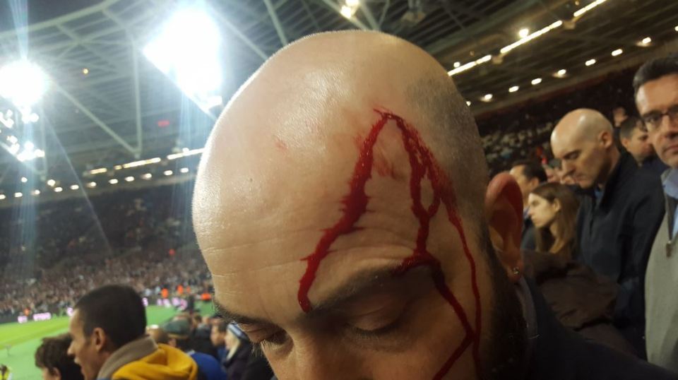  A Chelsea supporter was apparently cut after a West Ham fan threw a coin at his head