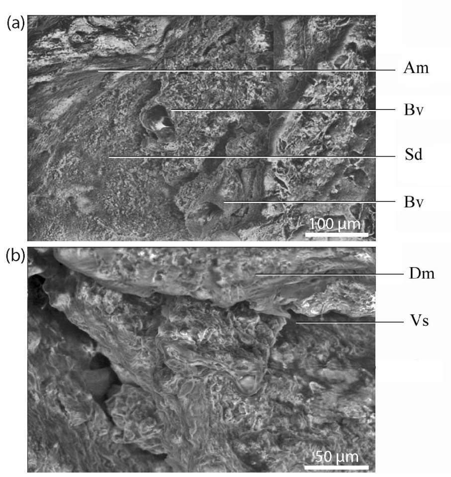  The fossil retained distinctive features such as the meninges - a protective membrane surrounding the brain - blood vessels, collagen and structures thought to represent the outer layer of nerve cells