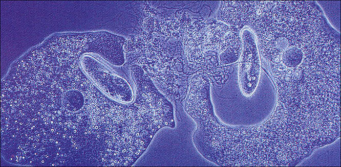  Amoebae and paramecium, both single-celled creatures