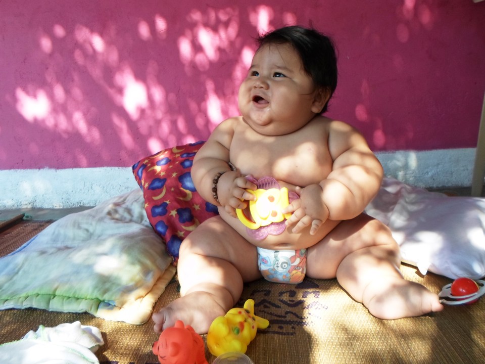  In 2013 Colombian toddler Santiago Mendoza who hit the headlines for weighing 3.1 stone at eight months