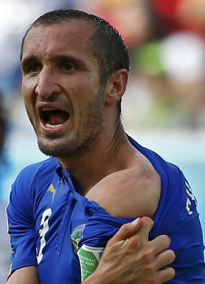  Italy's Giorgio Chiellini shows his shoulder after he was bitten by Uruguay's Luis Suarez in a World Cup clash