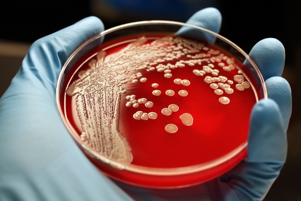  MRSA colonies are seen here on a blood agar plate in a laboratory environment