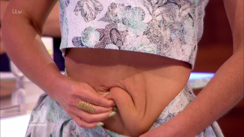 She appeared on Loose Women earlier this year and revealed her plans for surgery 