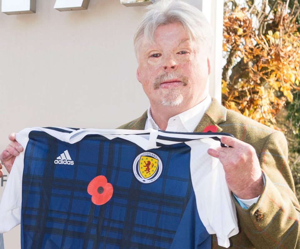  Simon Weston ... Welsh Guardsman, 55, suffered 46 per cent burns in Falklands. Does extensive charity work.