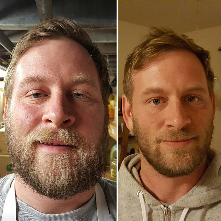  Giving up alcohol has left this man with a glowing complexion