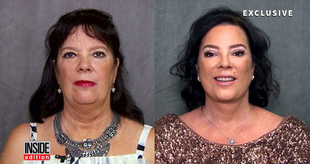  Kris Jenner's sister Karen Houghton pictured before and after her facelift