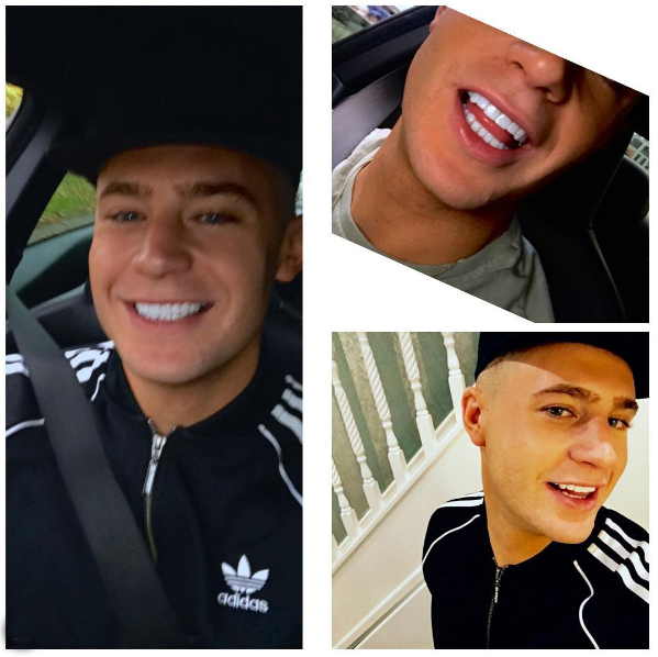  Scotty shared a series of snaps on Instagram showing off his new smile