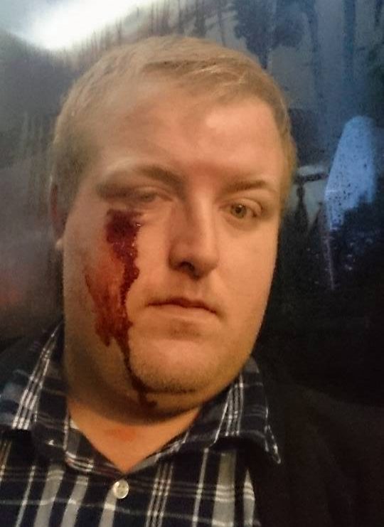  Bloodied railworker Nathan Gibson posted social media photo of his injury