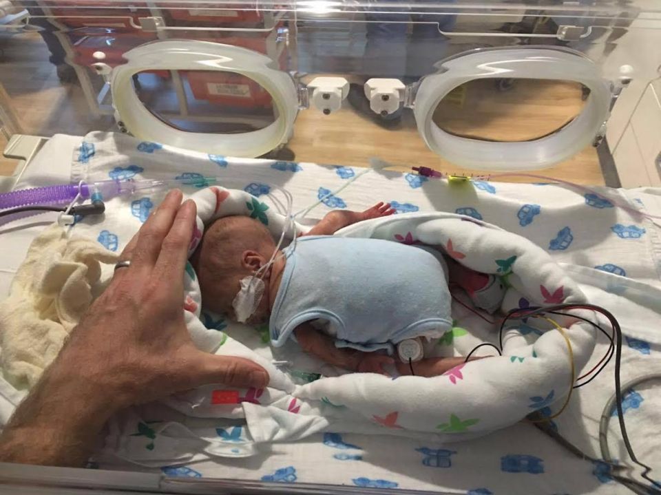  Tiny baby George ... tot amazingly survived emergency C-section just 27 weeks into the pregnancy