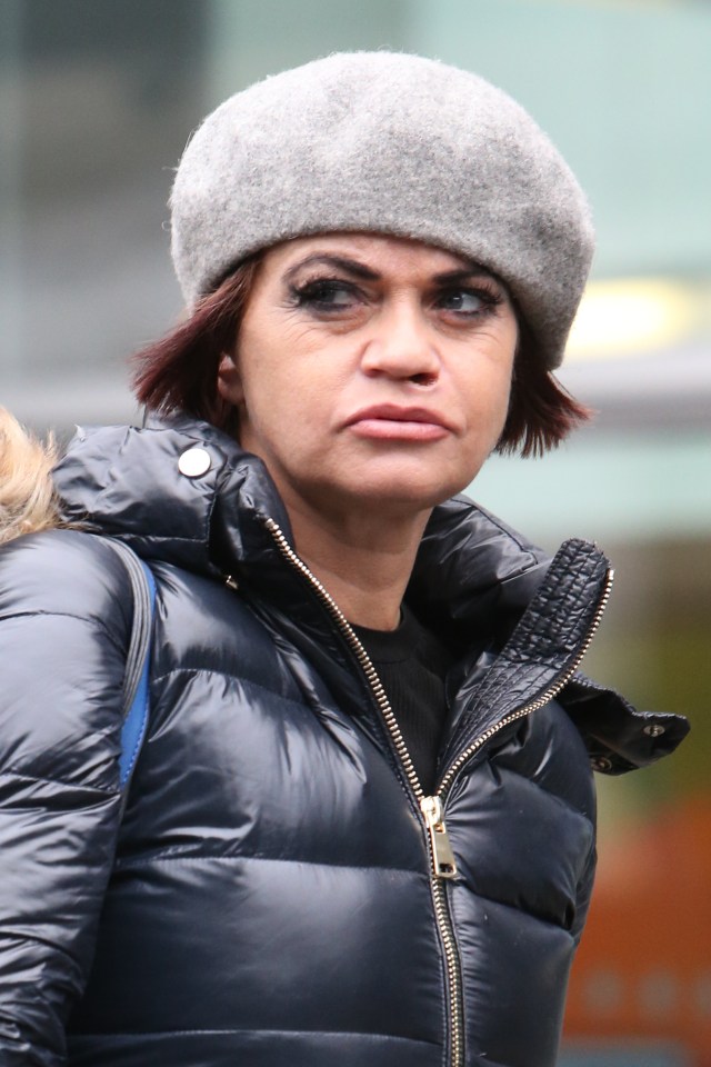  Danniella Westbrook showed off the wound beneath her nose for the first time today