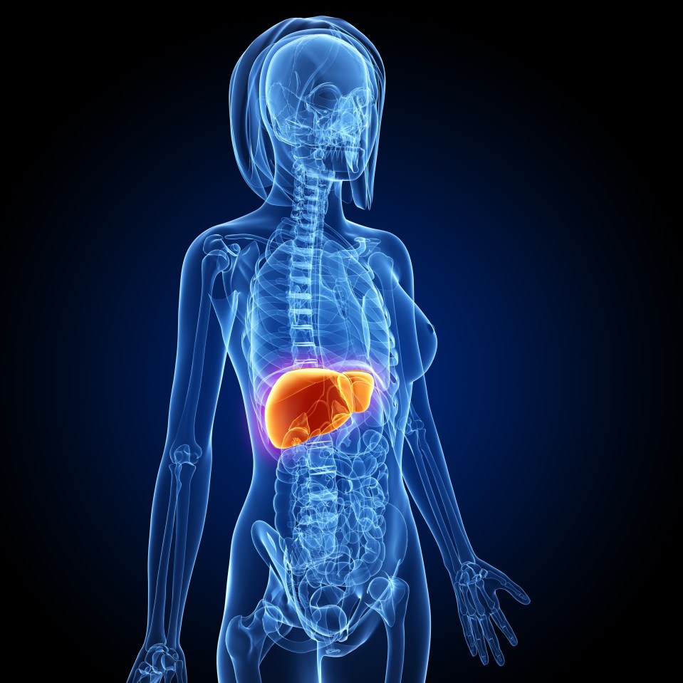 Liver cancer, computer artwork.