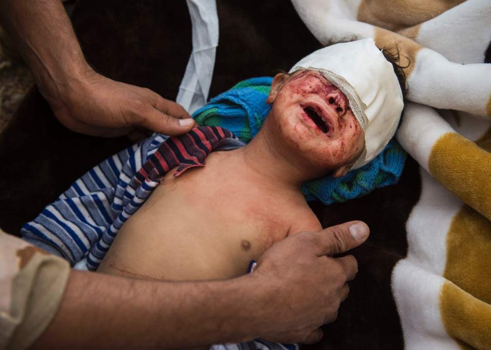  18-month old Jassem is comforted by a medic as he's treated  for shrapnel injuries