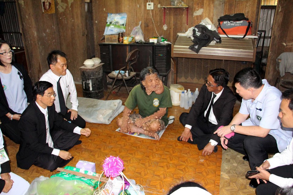  Hospital volunteers regularly visit Shiti, who has been a recluse for 45 years