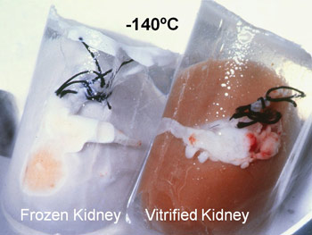  Even kidneys are kept frozen as part of the process