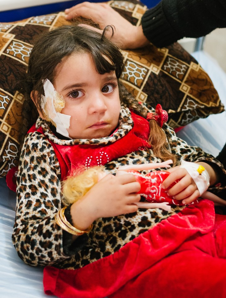  Injured ... little Norhan, aged just five, has shrapnel buried in her skull