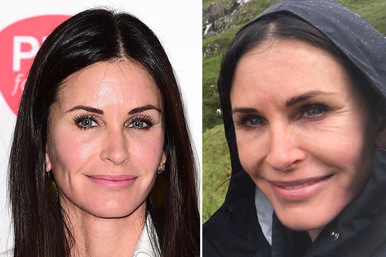  Courteney Cox opened up about her ever-changing face this year and admitted that regretted messing with her face, although said that they were things that “dissolve and go away”