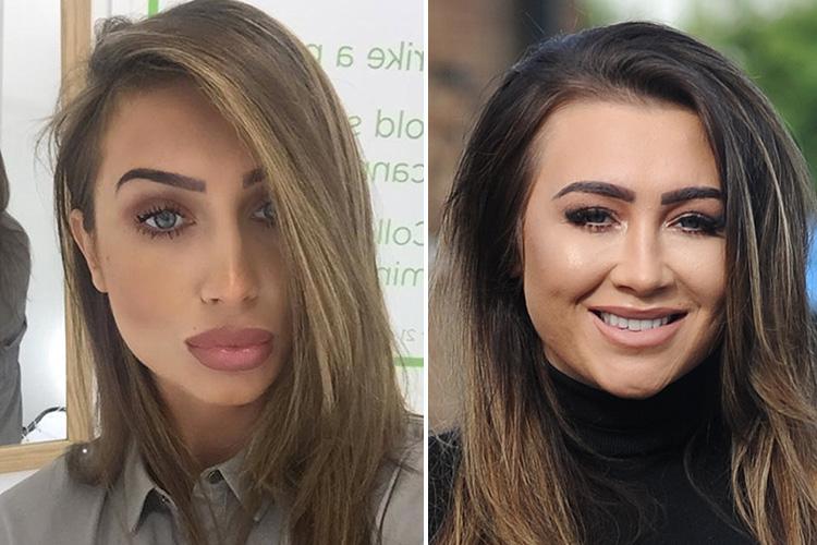  Lauren Goodger ditched the lip fillers in August after having them for five years and is even considering returning to her natural boobs as well