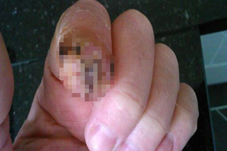  Kier, who bit Brian's finger off was later cleared of serious assault after claiming self-defence