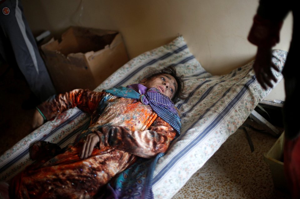  A wounded Iraqi girl lies on a bed at a field hospital in al-Samah