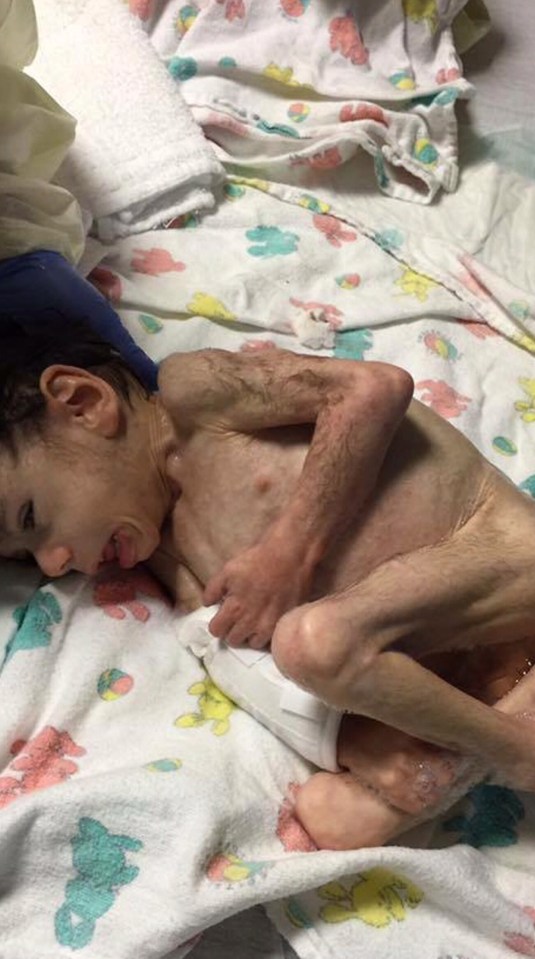  Baby Ryan weighed just 8lbs and was severely malnourished