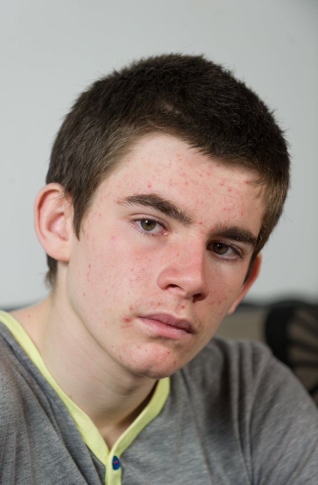  Jamie, 15, was attacked by a gang of thugs with hockey sticks during the summer holidays